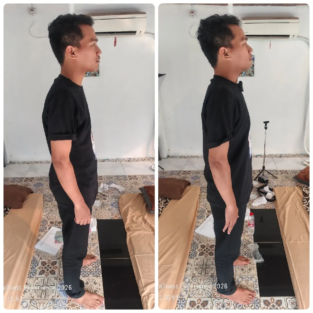 Perbandingan postur peserta tampak samping, sebelum dan sesudah sesi Yumeiho