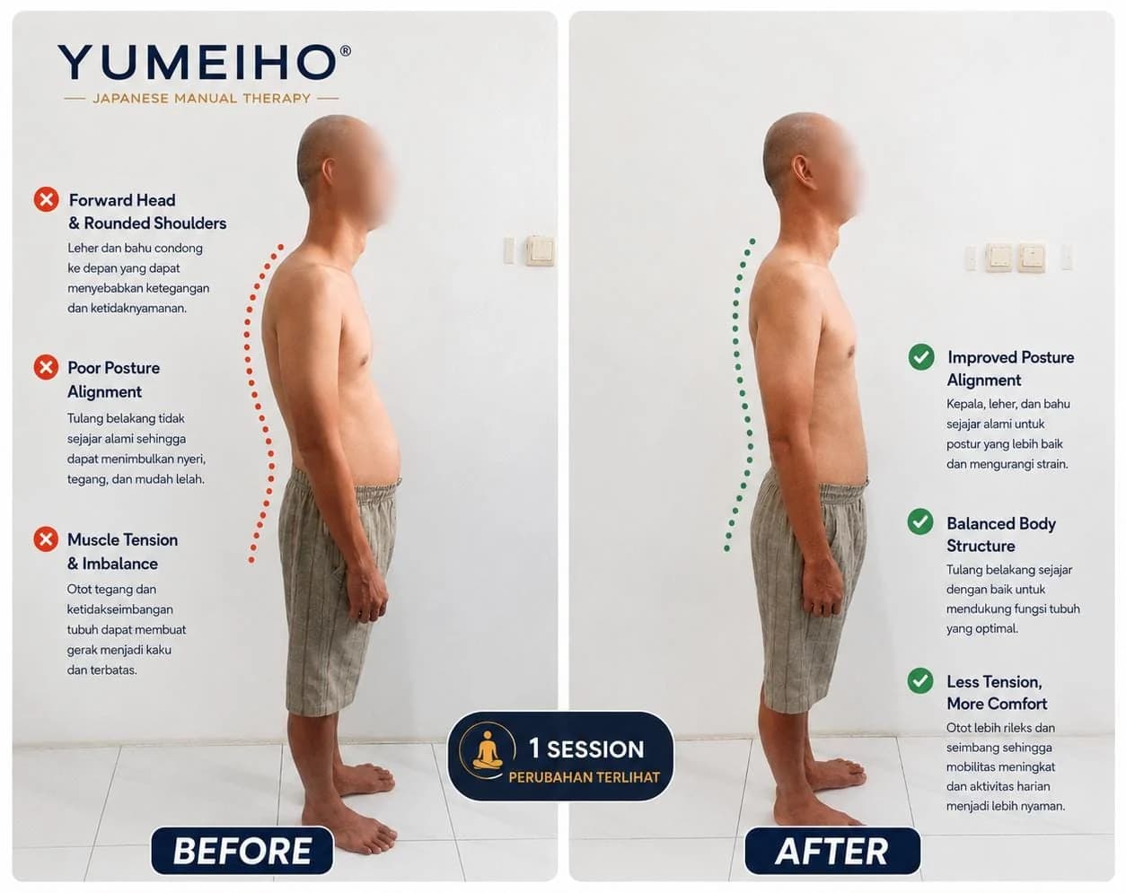 Perbandingan postur tampak samping sebelum dan sesudah satu sesi Yumeiho, dengan catatan perubahan pada kepala, bahu, tulang belakang, dan ketegangan otot